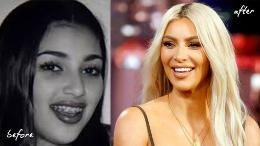 Kim Kardashian Teeth: The Truth About Whether They're Natural or Enhanced