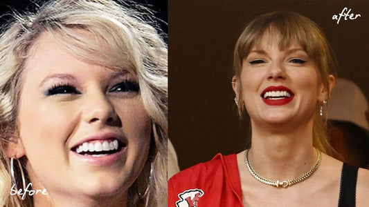 taylor swift teeth