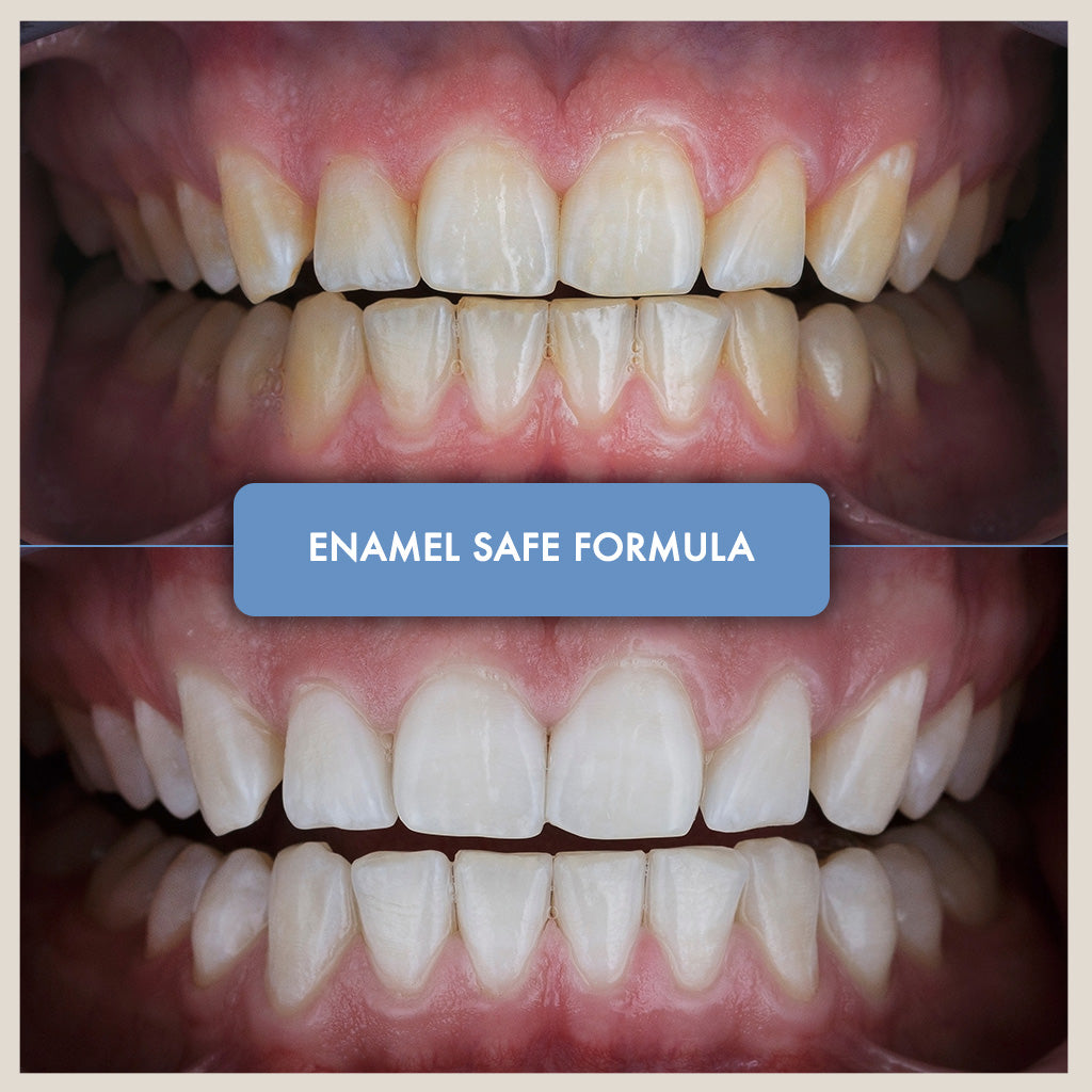 Non-Slip Teeth Whitening Strips - Iconic White
