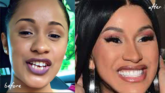 The Truth About Cardi B Teeth: Costs, Transformations, and Care Tips