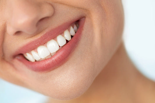 How to Have White Teeth (Without the Drama)