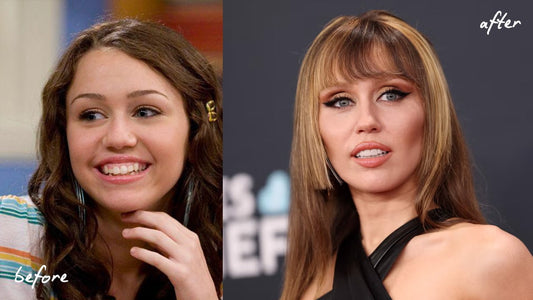 Miley Cyrus Teeth Transformation: A Closer Look at Her Smile Changes