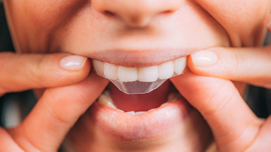 How Do Teeth Whitening Strips Work?