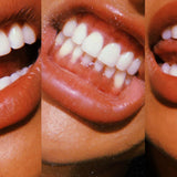 Vacay Teeth Whitening