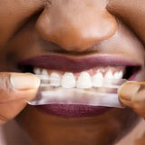Vacay Teeth Whitening