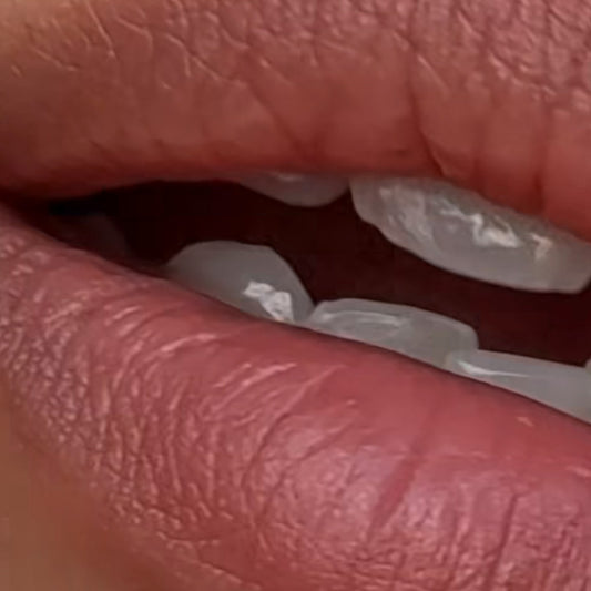 Non-Slip Teeth Whitening Strips - Iconic White